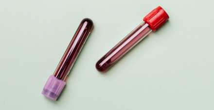 Congenital Macrothrombocytopenia (CM)